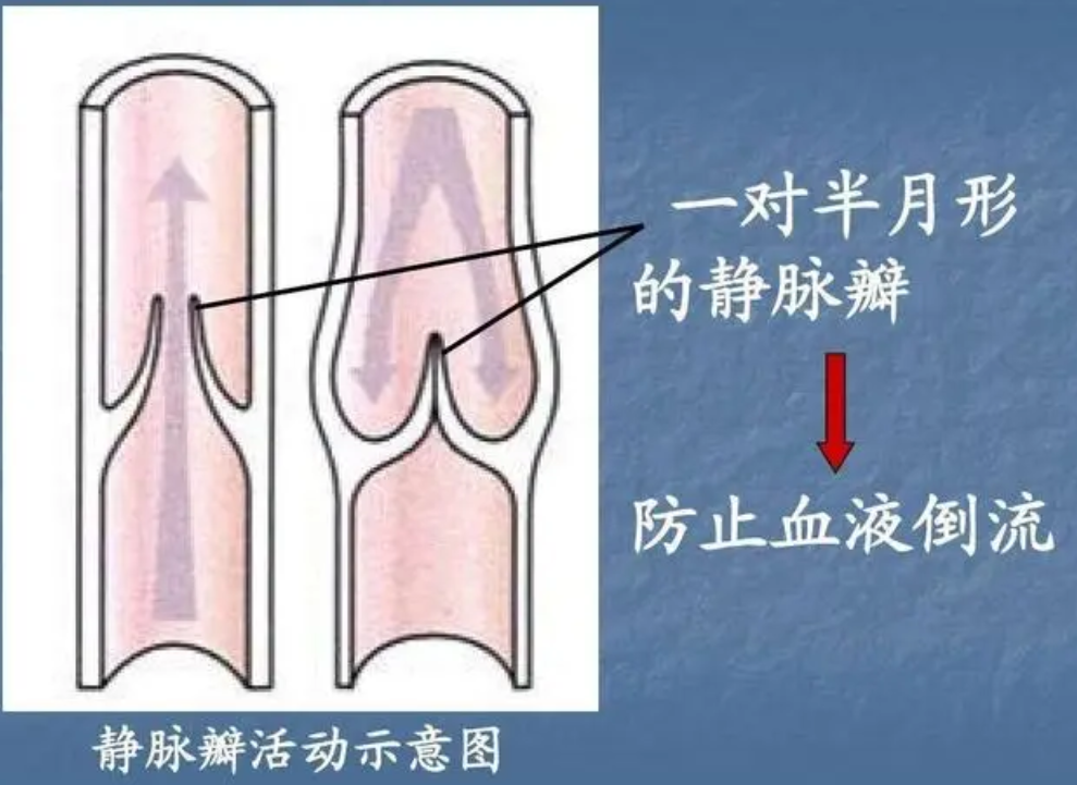 治疗静脉曲张瓣膜的食品
