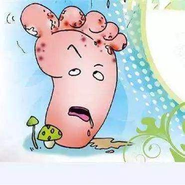 糖尿病足2