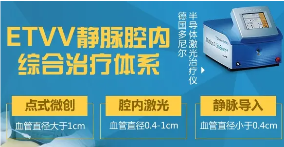 静脉曲张ETVV静脉腔内综合治疗
